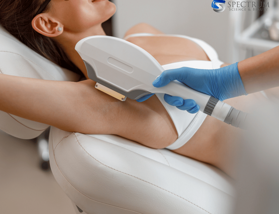 intense pulsed light hair removal